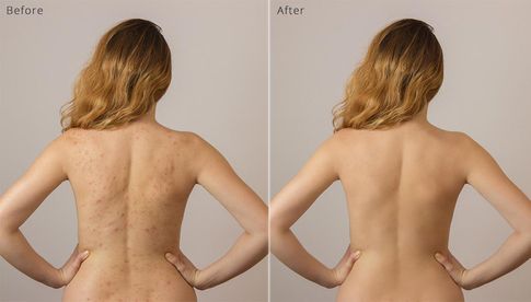 „PortraitPro Body“ führt auch die Retusche von Hautpartien automatisch durch.